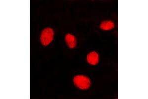 Immunofluorescent analysis of Lamin A/C staining in HeLa cells. (Lamin A/C Antikörper  (Center))