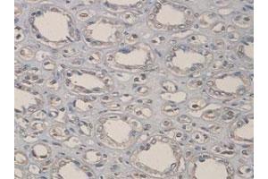 Immunohistochemical staining of formalin-fixed paraffin-embedded human kidney tissue with ADAMTS1 polyclonal antibody  at 1 : 100 dilution. (ADAMTS1 Antikörper  (C-Term))