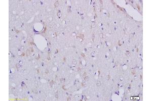 Immunohistochemistry (IHC) image for anti-C-Type Lectin Domain Family 1, Member A (CLEC1A) (AA 151-280) antibody (ABIN741795)