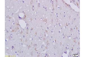 Formalin-fixed and paraffin embedded rat brain tissue labeled with Anti-CLEC1/CLEC1A Polyclonal Antibody, Unconjugated (ABIN741795) at 1:200 followed by conjugation to the secondary antibody and DAB staining (CLEC1A Antikörper  (AA 151-280))