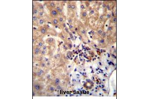 Immunohistochemistry (Paraffin-embedded Sections) (IHC (p)) image for anti-Dishevelled Segment Polarity Protein 1 (DVL1) (AA 442-470) antibody (ABIN656260)