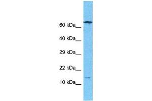 Host:  Rabbit  Target Name:  BMF  Sample Type:  Ovary Tumor lysates  Antibody Dilution:  1ug/ml (BMF Antikörper  (N-Term))