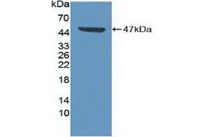 Figure. (CDK8 Antikörper  (AA 21-392))