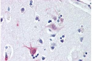 Anti-WNT8B antibody  ABIN1049486 IHC staining of human brain, cortex. (WNT8B Antikörper  (C-Term))
