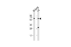 All lanes : Anti-Yes1 Antibody (Center) at 1:2000 dilution Lane 1: mouse lung lysates Lane 2: L6 whole cell lysates Lysates/proteins at 20 μg per lane. (YES1 Antikörper  (AA 148-182))