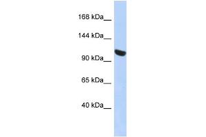 WB Suggested Anti-UBA1 Antibody Titration: 0. (UBA1 Antikörper  (N-Term))