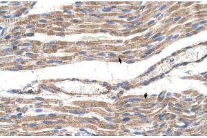 Human Muscle (SLC2A6 Antikörper  (C-Term))