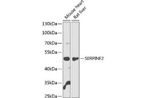 Western blot analysis of extracts of various cell lines, using SERPINF2 antibody  at 1:1000 dilution. (alpha 2 Antiplasmin Antikörper  (AA 302-491))