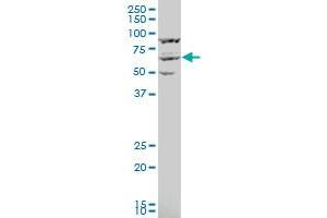 KPNA3 polyclonal antibody (A01), Lot # FAK0060120QCS1 Western Blot analysis of KPNA3 expression in IMR-32 .