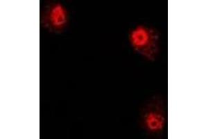 Immunofluorescent analysis of PHYH staining in U2OS cells.