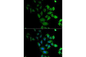 Immunofluorescence analysis of U2OS cell using PSG1 antibody. (PSG1 Antikörper)