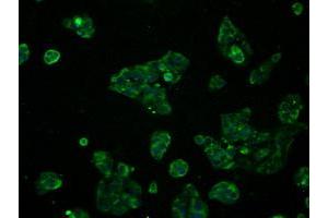 Immunofluorescent staining of HeLa cells using anti-RNF144B mouse monoclonal antibody (ABIN2453611). (RNF144B Antikörper  (AA 1-256))