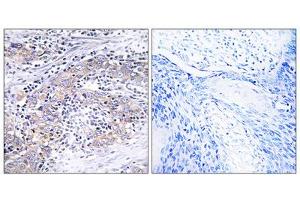 Immunohistochemistry analysis of paraffin-embedded human cervix tissue using CLN6 antibody. (CLN6 Antikörper  (C-Term))