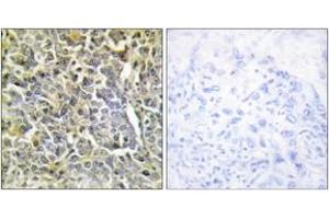 Immunohistochemistry (IHC) image for anti-Collagen, Type VI, alpha 2 (COL6A2) (AA 691-740) antibody (ABIN1534347)