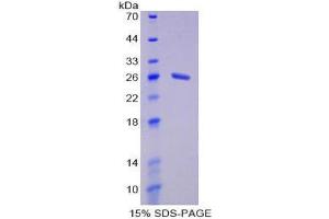 SDS-PAGE (SDS) image for Membrane Protein, Palmitoylated 6 (MAGUK P55 Subfamily Member 6) (MPP6) (AA 34-235) protein (His tag) (ABIN2125843) (MPP6 Protein (AA 34-235) (His tag))