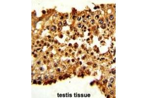 Immunohistochemistry (IHC) image for anti-Pituitary Tumor-Transforming 1 (PTTG1) antibody (ABIN3003161) (PTTG1 Antikörper)