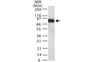 Western blot detection of TEM8 in TEM8 transfected 293 cell lysate. (ANTXR1 Antikörper  (AA 481-497))