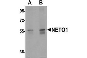 Western blot analysis of NETO1 in human lung tissue lysate with NETO1 Antibody  at (A) 1 and (B) 2 μg/mL. (NETO1 Antikörper  (C-Term))