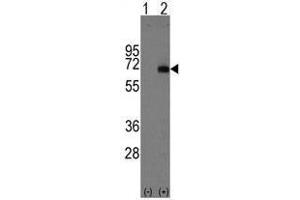 Image no. 1 for anti-alpha-Fetoprotein (AFP) (Center) antibody (ABIN356915) (alpha Fetoprotein Antikörper  (Center))