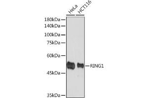 Western blot analysis of extracts of various cell lines, using RING1A Rabbit mAb (ABIN7270051) at 1:1000 dilution. (RING1 Antikörper)