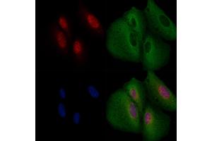 ABIN6264049 and ABIN6266617 staining  cells by IF/ICC. (PAX5 Antikörper  (N-Term))