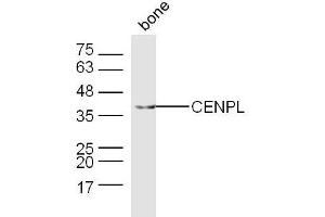 Mouse bone lysates probed with CENPL Polyclonal Antibody, Unconjugated  at 1:300 dilution and 4˚C overnight incubation. (CENPL Antikörper  (AA 51-150))