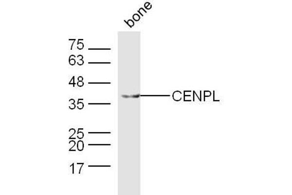 CENPL Antikörper  (AA 51-150)