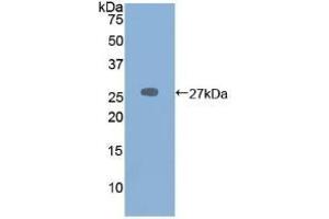 Detection of Recombinant PRSS2, Mouse using Polyclonal Antibody to Protease, Serine 2 (PRSS2) (PRSS2 Antikörper  (AA 29-240))