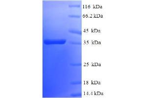 SDS-PAGE (SDS) image for BCL2-Like 2 (BCL2L2) (AA 2-193) protein (His-SUMO Tag) (ABIN5711533) (BCL2L2 Protein (AA 2-193) (His-SUMO Tag))