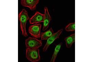 Immunofluorescence analysis of NTERA-2 cells using KDM4A mouse mAb (green). (KDM4A Antikörper)
