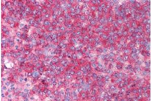 Human Spleen (formalin-fixed, paraffin-embedded) stained with CD82 antibody ABIN213919 at 0. (CD82 Antikörper  (C-Term))