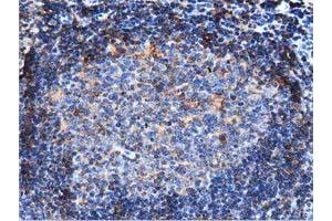 Immunohistochemistry (IHC) image for anti-rho GTPase Activating Protein 25 (ARHGAP25) antibody (ABIN1496701) (ARHGAP25 Antikörper)