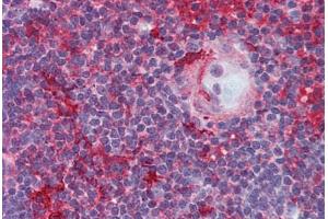 Human Thymus (formalin-fixed, paraffin-embedded) stained with LCK antibody ABIN296046 at 5 ug/ml followed by biotinylated anti-mouse IgG secondary antibody ABIN481714, alkaline phosphatase-streptavidin and chromogen. (LCK Antikörper)