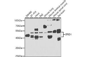 Western blot analysis of extracts of various cell lines, using IFRD1 antibody (ABIN6129279, ABIN6142215, ABIN6142217 and ABIN6223314) at 1:1000 dilution. (IFRD1 Antikörper  (AA 1-240))