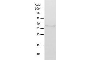 HMBS Protein (AA 1-361) (His tag)