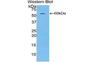 Western Blotting (WB) image for anti-H2A Histone Family, Member Y (H2AFY) (AA 109-369) antibody (ABIN1859115) (H2AFY Antikörper  (AA 109-369))