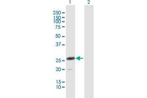 Western Blotting (WB) image for anti-C-Type Lectin Domain Family 4, Member D (CLEC4D) (AA 1-215) antibody (ABIN531615)