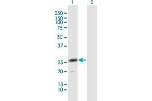 Western Blot analysis of CLEC4D expression in transfected 293T cell line by CLEC4D MaxPab polyclonal antibody. (CLEC4D Antikörper  (AA 1-215))