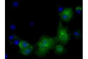 Anti-PKLR mouse monoclonal antibody (ABIN2453473) immunofluorescent staining of COS7 cells transiently transfected by pCMV6-ENTRY PKLR (RC206455). (PKLR Antikörper)