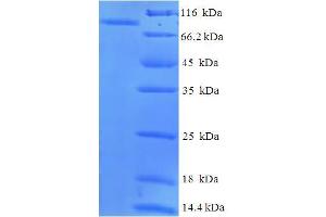 SDS-PAGE (SDS) image for Albumin (ALB) (AA 25-608) protein (His-SUMO Tag) (ABIN5709035)