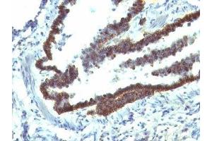 Formalin-fixed, paraffin-embedded rat lung stained with EpCAM antibody (EGP40/1110). (EpCAM Antikörper  (Cytoplasmic Domain))