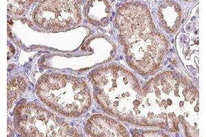 ABIN6267002 at 1/100 staining human kidney tissue sections by IHC-P. (MRRF Antikörper  (Internal Region))