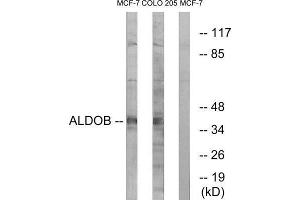 Western Blotting (WB) image for anti-Aldolase B, Fructose-Bisphosphate (ALDOB) (Internal Region) antibody (ABIN1851339) (ALDOB Antikörper  (Internal Region))