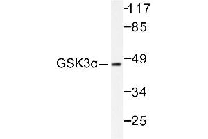 Image no. 1 for anti-Glycogen Synthase Kinase 3 alpha (GSK3a) antibody (ABIN265449) (GSK3 alpha Antikörper)