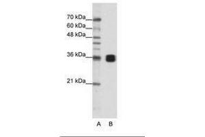 Image no. 1 for anti-Heterogeneous Nuclear Ribonucleoprotein A0 (HNRNPA0) (AA 154-203) antibody (ABIN202208) (HNRNPA0 Antikörper  (AA 154-203))