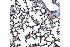IHC analysis of ACE using anti-ACE antibody (ABIN3043777).