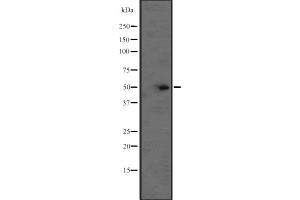 Western blot analysis of BCL2L13 expression in CEM cell line lysate ,The lane on the left is treated with the antigen-specific peptide. (BCL2L13 Antikörper  (Internal Region))