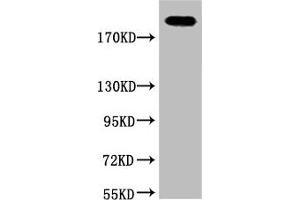 Western blot analysis of Hela, diluted at 1:2000. (Fibronectin 1 Antikörper)