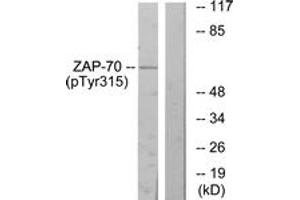 Western blot analysis of extracts from Jurkat cells treated with Ca+ 40nM 30', using ZAP-70 (Phospho-Tyr315) Antibody.