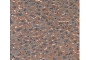 Used in DAB staining on fromalin fixed paraffin- embedded Kidney tissue (Complement C4 Antikörper  (AA 126-366))
